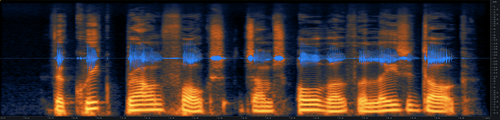 Edited Audio Spectrogram